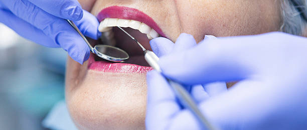 Best Emergency Treatment for Dental Infections or Abscesses in Lakewood, OH